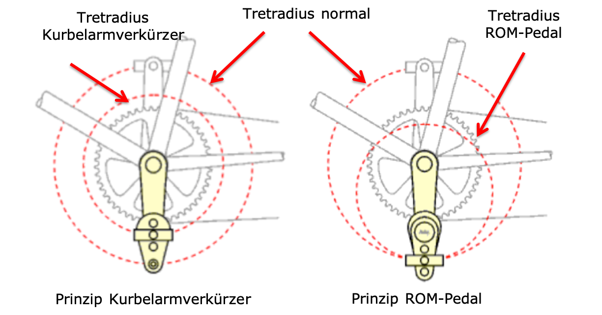 Fietsen op Maat - prinzip kurbelarmverkurzer und ROM pedal